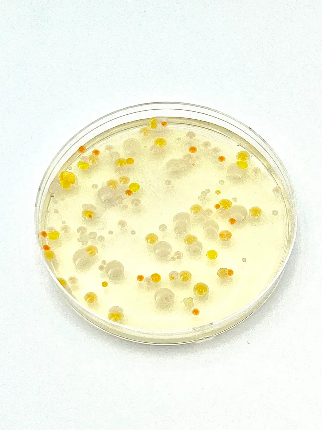 Air Plate Sampling Roesink Microbiology